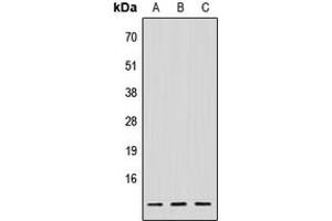 Western blot analysis of NDUFV3 expression in HeLa (A), Raw264. (NDUFV3 antibody  (Center))