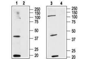 Western blot analysis of human HL-60 acute promyelocytic leukemia cell line lysate (lanes 1 and 2) and human MCF-7 breast adenocarcinoma cell line lysate (lanes 3 and 4):  - 1,3. (CNR2 antibody  (Extracellular, N-Term))
