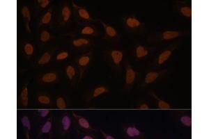 Immunofluorescence analysis of U-2 OS cells using FCF1 Polyclonal Antibody at dilution of 1:100. (FCF1 antibody)