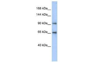 CCDC52 antibody used at 1 ug/ml to detect target protein. (SPICE1 antibody  (Middle Region))