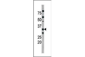 The anti-Phospho-Cdk2- Pab (ABIN389540 and ABIN2839586) is used in Western blot to detect Phospho-Cdk2- in  tissue lysate (CDK2 antibody  (pThr160))