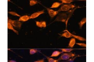 Immunofluorescence analysis of NIH-3T3 cells using RAB11A Polyclonal Antibody at dilution of 1:100. (RAB11A antibody)