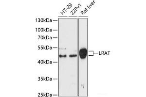 Western blot analysis of extracts of various cell lines using LRat Polyclonal Antibody at dilution of 1:3000. (LRAT antibody)