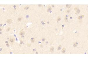 Detection of ASM in Human Cerebrum Tissue using Polyclonal Antibody to Acid Sphingomyelinase (ASM) (SMPD1 antibody  (AA 319-579))