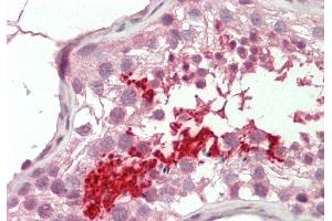 Rabbit Anti-BRDT antibody  Formalin Fixed Paraffin Embedded Tissue: Human Testis Primary antibody Concentration: 1:100 Secondary Antibody: Donkey anti-Rabbit-Cy3 Secondary Antibody Concentration: 1:200 Magnification: 20x Exposure Time: 0. (BRDT antibody  (N-Term))