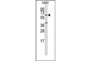 Image no. 1 for anti-Kruppel-Like Factor 4 (Gut) (KLF4) antibody (ABIN357865) (KLF4 antibody)