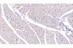 Immunohistochemistry (IHC) image for anti-PDZ and LIM Domain 1 (PDLIM1) (AA 2-329) antibody (ABIN7441679)