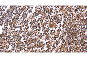 Immunohistochemistry of paraffin-embedded Human tonsil tissue using CRK Polyclonal Antibody at dilution 1:40 (Crk antibody)