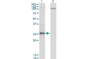 Western Blot analysis of RNF138 expression in transfected 293T cell line by RNF138 monoclonal antibody (M01A), clone 3G2.