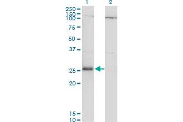RNF138 Antikörper  (AA 51-150)
