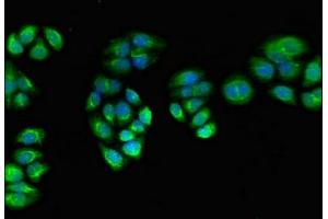 Immunofluorescent analysis of PC-3 cells using ABIN7166589 at dilution of 1:100 and Alexa Fluor 488-congugated AffiniPure Goat Anti-Rabbit IgG(H+L) (PPOX antibody  (AA 1-477))