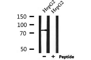 Western blot analysis of extracts from HepG2, using ENaC γ Antibody. (SCNN1G antibody  (C-Term))