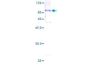 PHF17 Protein (AA 1-509) (GST tag)