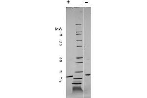 SDS-PAGE (SDS) image for Fibroblast Growth Factor 2 (Basic) (FGF2) protein (ABIN6699845)