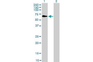 Western Blot analysis of RAF1 expression in transfected 293T cell line by RAF1 monoclonal antibody (M03), clone 1H4. (RAF1 antibody  (AA 1-130))