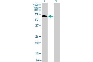 Western Blot analysis of RAF1 expression in transfected 293T cell line by RAF1 monoclonal antibody (M03), clone 1H4.
