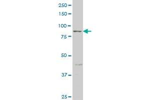 RIPK4 monoclonal antibody (M02), clone 1G2 Western Blot analysis of RIPK4 expression in HepG2 . (RIPK4 antibody  (AA 675-784))
