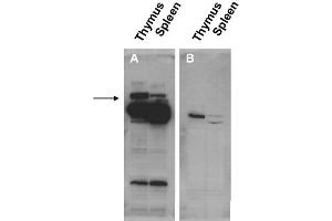 Image no. 1 for anti-Pogo Transposable Element with ZNF Domain (POGZ) (N-Term) antibody (ABIN401435) (POGZ antibody  (N-Term))