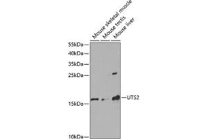 Western blot analysis of extracts of various cell lines, using UTS2 antibody (ABIN6128895, ABIN6150039, ABIN6150040 and ABIN6220965) at 1:1000 dilution. (Urotensin 2 antibody  (AA 35-124))