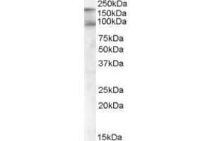 ABIN184664 (1µg/ml) staining of Human Colon lysate (35µg protein in RIPA buffer). (CDCP1 antibody  (C-Term))