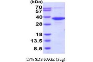 SDS-PAGE (SDS) image for Phosphoglycolate Phosphatase (PGP) (AA 1-321) (Active) protein (His tag) (ABIN6388008) (PGP Protein (AA 1-321) (His tag))