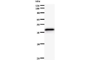 Western Blotting (WB) image for anti-Protein Kinase, CAMP-Dependent, Regulatory, Type I, alpha (Tissue Specific Extinguisher 1) (PRKAR1A) antibody (ABIN931105) (PRKAR1A antibody)