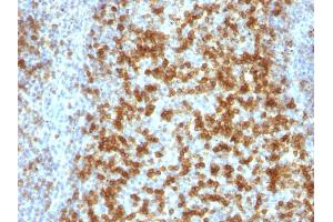 Formalin-fixed, paraffin-embedded human Tonsil stained with PD1 (CD279) Monoclonal Antibody (PDCD1/922).
