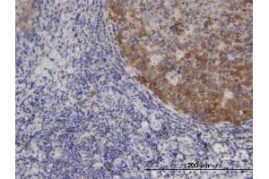 Immunoperoxidase of monoclonal antibody to XCL1 on formalin-fixed paraffin-embedded human tonsil. (XCL1 antibody  (AA 22-114))