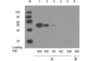 Lane 1,2,3 and 6: WISP2 full length recombinant protein with GST tag in 293 cell lysateLane 4: 10 µg 293 cell lysateLane 5: GST proteinPrimary antibody: A: 1 µg/mL Mouse Anti-WISP2 Monoclonal Antibody (ABIN398657) B: Negative controlSecondary antibody: Goat Anti-Mouse IgG (H&L) [HRP] Polyclonal Antibody (ABIN398387, 1: 10,000) The signal was developed with LumiSensorTM HRP Substrate Kit (ABIN769939) (WISP2 antibody)