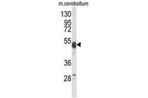 Western blot analysis of UBAP1 Antibody (N-term) in mouse cerebellum tissue lysates (35ug/lane). (UBAP1 antibody  (N-Term))