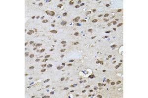 Immunohistochemistry of paraffin-embedded rat brain using RNF166 antibody (ABIN5974659) (40x lens). (RNF166 antibody)