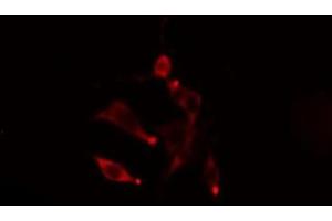 ABIN6275470 staining  LOVO cells by IF/ICC. (Rab5c antibody  (Internal Region))