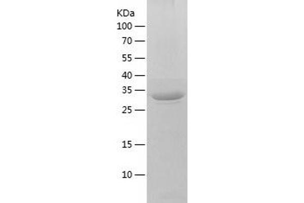 CANT1 Protein (AA 63-401) (His tag)