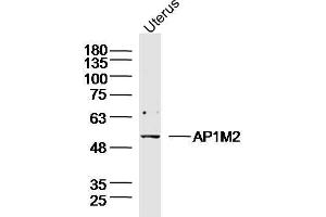 Mouse Uterus lysates probed with AP1M2 Polyclonal Antibody, unconjugated  at 1:300 overnight at 4°C followed by a conjugated secondary antibody for 60 minutes at 37°C. (AP1m2 antibody  (AA 1-100))