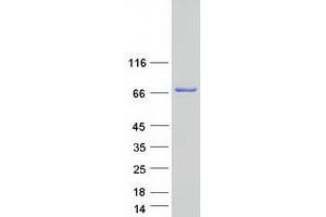 Validation with Western Blot