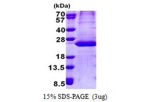SDS-PAGE (SDS) image for PPPDE Peptidase Domain Containing 2 (PPPDE2) (AA 1-168) protein (His tag) (ABIN5853131) (DESI1 Protein (AA 1-168) (His tag))