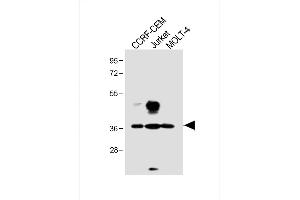 All lanes : Anti-TAL1 Antibody (T90) at 1:1000 dilution Lane 1: CCRF-CEM whole cell lysate Lane 2: Jurkat whole cell lysate Lane 3: MOLT-4 whole cell lysate Lysates/proteins at 20 μg per lane. (TAL1 antibody  (AA 68-97))