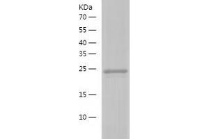 Western Blotting (WB) image for RAB18, Member RAS Oncogene Family (RAB18) (AA 1-206) protein (His tag) (ABIN7124739) (RAB18 Protein (AA 1-206) (His tag))