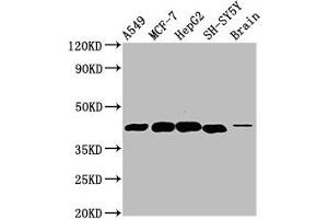 Western Blot Positive WB detected in: A549 whole cell lysate, MCF-7 whole cell lysate, HepG2 whole cell lysate, SH-SY5Y whole cell lysate, Rat brain tissue All lanes: DLK1 antibody at 4.