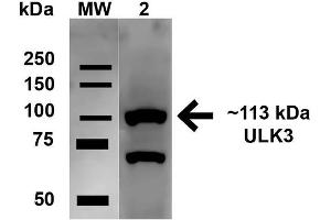 Western blot analysis of Human HeLa cell lysates showing detection of 112. (ULK2 antibody  (AA 558-569) (Atto 488))