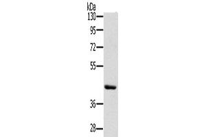 Western Blotting (WB) image for anti-Hydroxy-delta-5-Steroid Dehydrogenase, 3 beta- and Steroid delta-Isomerase 7 (HSD3B7) antibody (ABIN2430267)