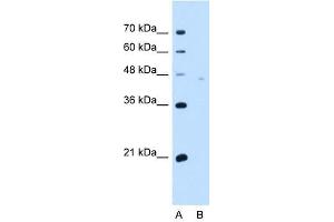 Neuroplastin antibody used at 5 ug/ml to detect target protein. (NPTN antibody  (Middle Region))