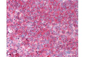 Anti-CD82 antibody IHC of human spleen. (CD82 antibody  (C-Term))