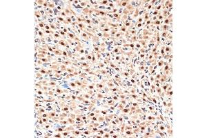 Immunohistochemistry of paraffin-embedded rat ovary using CDC16 Rabbit mAb (ABIN1678585, ABIN3017837, ABIN3017838 and ABIN7101525) at dilution of 1:100 (40x lens). (CDC16 antibody)