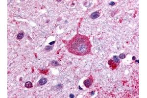 Image no. 1 for anti-G Protein-Coupled Receptor, Family C, Group 5, Member B (GPRC5B) (C-Term) antibody (ABIN181444) (GPRC5B antibody  (C-Term))