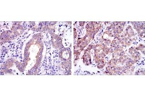 Immunohistochemistry (IHC) image for anti-REL proto-oncogene (c-Rel) antibody (ABIN968997)