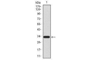 Image no. 2 for anti-HIR Histone Cell Cycle Regulation Defective Homolog A (HIRA) antibody (ABIN1490946) (HIRA antibody)