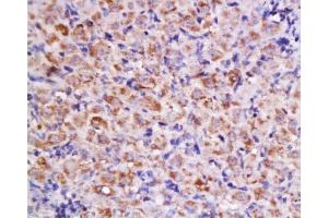 Immunohistochemistry (Paraffin-embedded Sections) (IHC (p)) image for anti-Cyclin D2 (CCND2) (AA 161-288) antibody (ABIN738366)