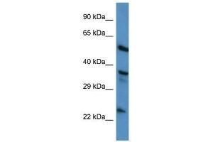 Western Blot showing ANXA1 antibody used at a concentration of 1. (Annexin a1 antibody  (N-Term))