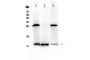 Western blot analysis of TFF3 using anti-TFF3 antibody . (TFF3 antibody  (AA 23-81))